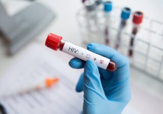 Secretaria de Saúde descarta suposto aumento de casos de HIV em jovens baianos